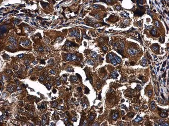 Anti-PKR antibody used in IHC (Paraffin sections) (IHC-P). GTX130941