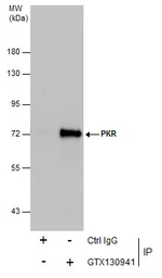 Anti-PKR antibody used in Immunoprecipitation (IP). GTX130941