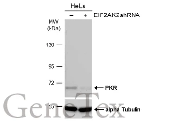 Anti-PKR antibody used in Western Blot (WB). GTX130941