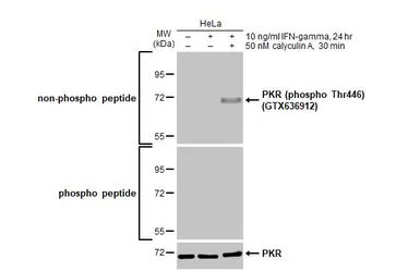 Anti-PKR antibody used in Western Blot (WB). GTX130941