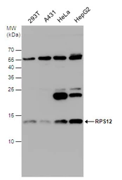 Anti-RPS12 antibody used in Western Blot (WB). GTX130942