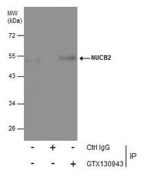 Anti-NUCB2 antibody used in Immunoprecipitation (IP). GTX130943