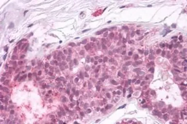 Anti-PTPRA antibody used in IHC (Paraffin sections) (IHC-P). GTX13095