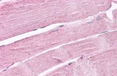 Anti-PTPRA antibody used in IHC (Paraffin sections) (IHC-P). GTX13095