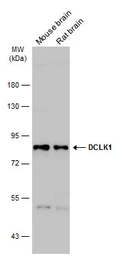 Anti-DCLK1 antibody used in Western Blot (WB). GTX130959
