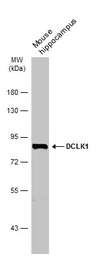 Anti-DCLK1 antibody used in Western Blot (WB). GTX130959
