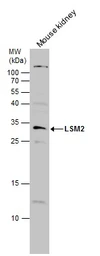 Anti-LSM2 antibody used in Western Blot (WB). GTX130964