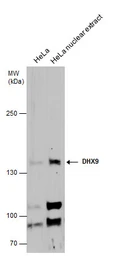 Anti-DHX9 antibody used in Western Blot (WB). GTX130971