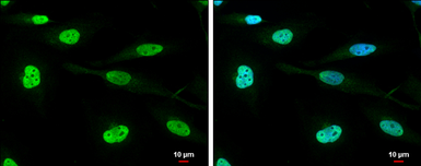 Anti-DHX9 antibody used in Immunocytochemistry/ Immunofluorescence (ICC/IF). GTX130971