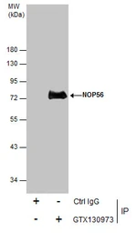 Anti-NOL5A antibody used in Immunoprecipitation (IP). GTX130973