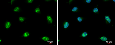 Anti-NOL5A antibody used in Immunocytochemistry/ Immunofluorescence (ICC/IF). GTX130973