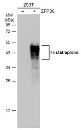 Anti-Tristetraprolin antibody used in Western Blot (WB). GTX130974