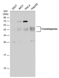 Anti-Tristetraprolin antibody used in Western Blot (WB). GTX130974