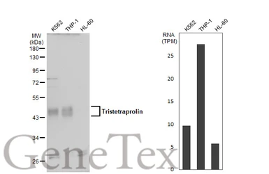 Anti-Tristetraprolin antibody used in Western Blot (WB). GTX130974