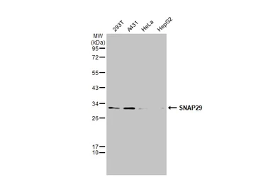 Anti-SNAP29 antibody used in Western Blot (WB). GTX131028
