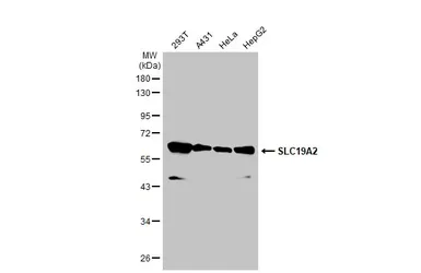 Anti-SLC19A2 antibody used in Western Blot (WB). GTX131042