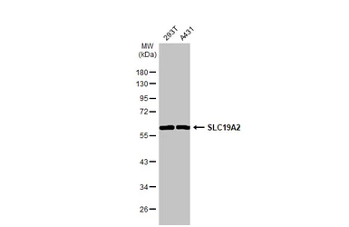 Anti-SLC19A2 antibody used in Western Blot (WB). GTX131042