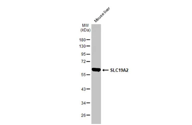 Anti-SLC19A2 antibody used in Western Blot (WB). GTX131042