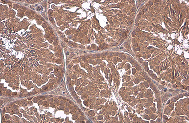Anti-G protein alpha 13 antibody used in IHC (Paraffin sections) (IHC-P). GTX131045
