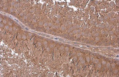 Anti-G protein alpha 13 antibody used in IHC (Paraffin sections) (IHC-P). GTX131045