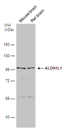 Anti-ALDH1L1 antibody used in Western Blot (WB). GTX131047