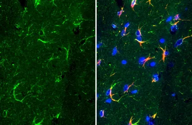 Anti-ALDH1L1 antibody used in IHC (Paraffin sections) (IHC-P). GTX131047