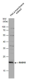 Anti-RAB18 antibody used in Western Blot (WB). GTX131055