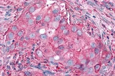 Anti-P2Y6 antibody used in IHC (Paraffin sections) (IHC-P). GTX13106