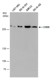 Anti-CHD5 antibody used in Western Blot (WB). GTX131065