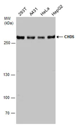 Anti-CHD5 antibody used in Western Blot (WB). GTX131065