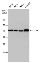 Anti-LAP3 antibody used in Western Blot (WB). GTX131074