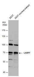 Anti-LARP7 antibody used in Western Blot (WB). GTX131082