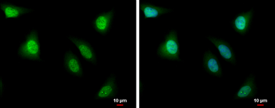 Anti-PBK antibody used in Immunocytochemistry/ Immunofluorescence (ICC/IF). GTX131112