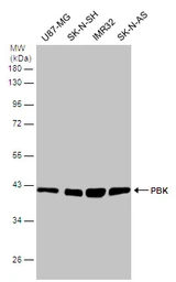 Anti-PBK antibody used in Western Blot (WB). GTX131112