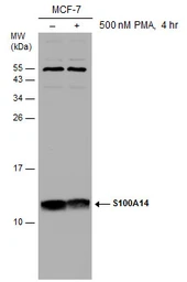 Anti-S100A14 antibody used in Western Blot (WB). GTX131119