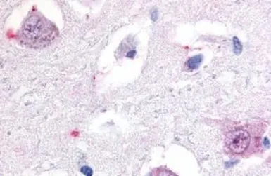 Anti-ROR beta antibody used in IHC (Paraffin sections) (IHC-P). GTX13112