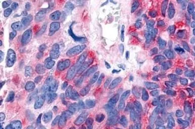 Anti-ROR beta antibody used in IHC (Paraffin sections) (IHC-P). GTX13112