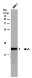 Anti-SELK antibody used in Western Blot (WB). GTX131124