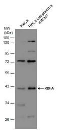 Anti-RBFA antibody used in Western Blot (WB). GTX131133