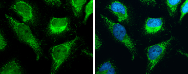 Anti-RBFA antibody used in Immunocytochemistry/ Immunofluorescence (ICC/IF). GTX131133