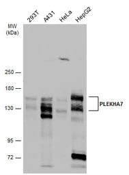 Anti-PLEKHA7 antibody used in Western Blot (WB). GTX131146