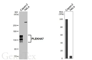 Anti-PLEKHA7 antibody used in Western Blot (WB). GTX131146