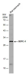 Anti-ALKBH3 antibody used in Western Blot (WB). GTX131151