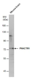 Anti-PHACTR1 antibody used in Western Blot (WB). GTX131152
