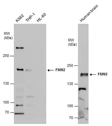 Anti-FMN2 antibody used in Western Blot (WB). GTX131161