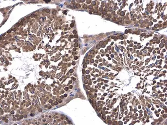Anti-DHX36 antibody used in IHC (Paraffin sections) (IHC-P). GTX131179