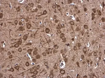 Anti-DHX36 antibody used in IHC (Paraffin sections) (IHC-P). GTX131179