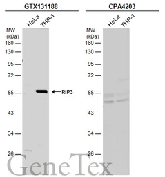 Anti-RIP3 antibody used in Western Blot (WB). GTX131188
