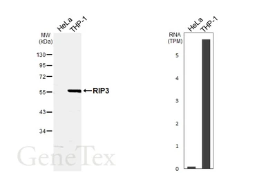 Anti-RIP3 antibody used in Western Blot (WB). GTX131188