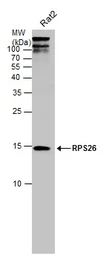 Anti-RPS26 antibody used in Western Blot (WB). GTX131193
